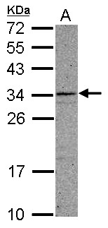 CCDC107 Antibody - Sample (30 ug of whole cell lysate) A: A549 12% SDS PAGE CCDC107 antibody diluted at 1:1000