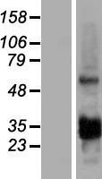 CCDC107 Protein - Western validation with an anti-DDK antibody * L: Control HEK293 lysate R: Over-expression lysate