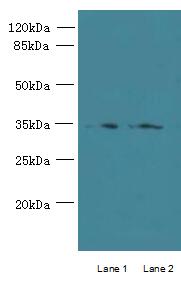 CCDC108 Antibody - Western blot. All lanes: CCDC108 antibody at 8 ug/ml. Lane 1: U251 whole cell lysate. Lane 2: U87 whole cell lysate. Secondary Goat polyclonal to Rabbit IgG at 1:10000 dilution. Predicted band size: 31 kDa. Observed band size: 31 kDa.