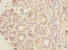 CCDC108 Antibody - Immunohistochemistry of paraffin-embedded human pancreatic tissue using antibody at dilution of 1:100.