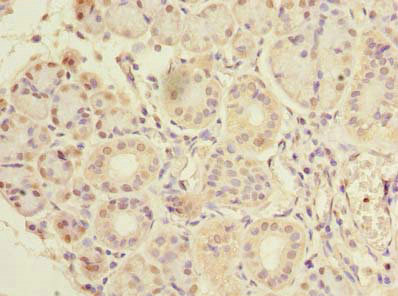 CCDC108 Antibody - Immunohistochemistry of paraffin-embedded human pancreatic tissue using CFAP65 Antibody at dilution of 1:100