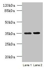 CCDC108 Antibody - Western blot All lanes: CCDC108 antibody at 8µg/ml Lane 1: U251 whole cell lysate Lane 2: U87 whole cell lysate Secondary Goat polyclonal to rabbit IgG at 1/10000 dilution Predicted band size: 218, 19, 82, 88 kDa Observed band size: 31 kDa