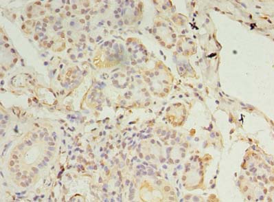 CCDC109B Antibody - Immunohistochemistry of paraffin-embedded human pancreatic tissue using antibody at dilution of 1:100.