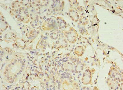 CCDC109B Antibody - Immunohistochemistry of paraffin-embedded human pancreatic tissue using MCUB Antibody at dilution of 1:100