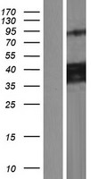 CCDC109B Protein - Western validation with an anti-DDK antibody * L: Control HEK293 lysate R: Over-expression lysate