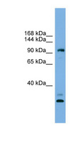CCDC110 Antibody - CCDC110 antibody Western blot of HeLa lysate. This image was taken for the unconjugated form of this product. Other forms have not been tested.