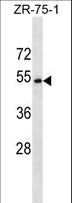 CCDC112 / MBC1 Antibody - CCDC112 Antibody western blot of ZR-75-1 cell line lysates (35 ug/lane). The CCDC112 antibody detected the CCDC112 protein (arrow).