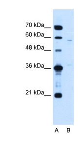 CCDC112 / MBC1 Antibody - CCDC112 antibody ARP44931_T100-NP_001035530-MGC39633 Antibody Western blot of Jurkat lysate.  This image was taken for the unconjugated form of this product. Other forms have not been tested.