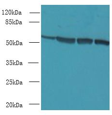 CCDC112 / MBC1 Antibody - Western blot. All lanes: CCDC112 antibody at 12 ug/ml. Lane 1: Jurkat whole cell lysate. Lane 2: HeLa whole cell lysate. Lane 3: HepG-2 whole cell lysate. Lane 4: A549 whole cell lysate. Secondary Goat polyclonal to Rabbit IgG at 1:10000 dilution. Predicted band size: 54 kDa. Observed band size: 54 kDa.