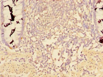 CCDC112 / MBC1 Antibody - Immunohistochemistry of paraffin-embedded human rectum tissue using antibody at dilution of 1:100.