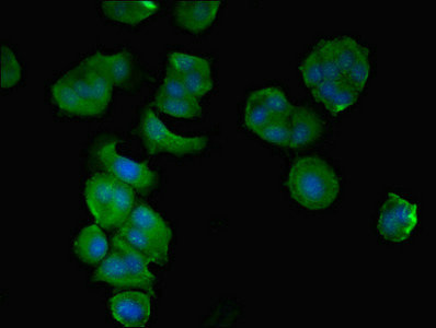 CCDC112 / MBC1 Antibody - Immunofluorescent analysis of MCF-7 cells using CCDC112 Antibody at dilution of 1:100 and Alexa Fluor 488-congugated AffiniPure Goat Anti-Rabbit IgG(H+L)