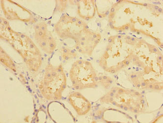 CCDC112 / MBC1 Antibody - Immunohistochemistry of paraffin-embedded human kidney tissue using CCDC112 Antibody at dilution of 1:100