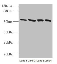 CCDC112 / MBC1 Antibody - Western blot All lanes: CCDC112 antibody at 12µg/ml Lane 1: Jurkat whole cell lysate Lane 2: Hela whole cell lysate Lane 3: HepG2 whole cell lysate Lane 4: A549 whole cell lysate Secondary Goat polyclonal to rabbit IgG at 1/10000 dilution Predicted band size: 54, 62 kDa Observed band size: 54 kDa