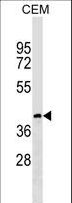 CCDC113 Antibody - CC113 Antibody western blot of CEM cell line lysates (35 ug/lane). The CC113 antibody detected the CC113 protein (arrow).