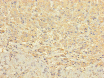 CCDC113 Antibody - Immunohistochemistry of paraffin-embedded human adrenal gland tissue using CCDC113 Antibody at dilution of 1:100
