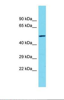 CCDC114 Antibody - Western blot of Human HT1080. CCDC114 antibody dilution 1.0 ug/ml.  This image was taken for the unconjugated form of this product. Other forms have not been tested.
