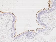 CCDC114 Antibody - Immunochemical staining of human CCDC114 in human bronchus with rabbit polyclonal antibody at 1:1000 dilution, formalin-fixed paraffin embedded sections.