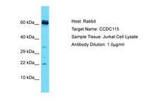 CCDC115 Antibody -  This image was taken for the unconjugated form of this product. Other forms have not been tested.
