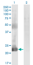 CCDC115 Antibody - Western blot of CCDC115 expression in transfected 293T cell line by CCDC115 monoclonal antibody (M05), clone 4E9.