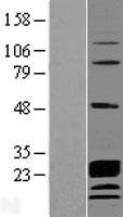CCDC115 Protein - Western validation with an anti-DDK antibody * L: Control HEK293 lysate R: Over-expression lysate