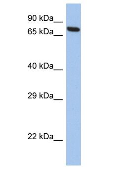 CCDC116 Antibody - CCDC116 antibody Western Blot of SH-SYSY. Antibody dilution: 1 ug/ml.  This image was taken for the unconjugated form of this product. Other forms have not been tested.
