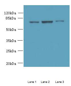 CCDC116 Antibody - Western blot. All lanes: CCDC116 antibody at 1.5 ug/ml. Lane 1: SH-SY5Y whole cell lysate. Lane 2: HeLa whole cell lysate. Lane 3: HCT116 whole cell lysate. Secondary antibody: Goat polyclonal to Rabbit IgG at 1:10000 dilution. Predicted band size: 68 kDa. Observed band size: 68 kDa.