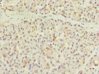 CCDC116 Antibody - Immunohistochemistry of paraffin-embedded human pancreatic tissue using CCDC116 Antibody at dilution of 1:100