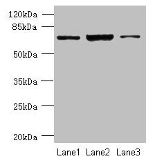CCDC116 Antibody - Western blot All lanes: CCDC116 antibody at 1.5µg/ml Lane 1: SH-SY5Y whole cell lysate Lane 2: Hela whole cell lysate Lane 3: HCT116 whole cell lysate Secondary Goat polyclonal to rabbit IgG at 1/10000 dilution Predicted band size: 57, 68, 58 kDa Observed band size: 68 kDa