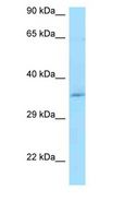 CCDC117 Antibody - CCDC117 antibody Western Blot of HeLa.  This image was taken for the unconjugated form of this product. Other forms have not been tested.