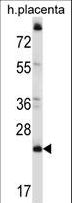 CCDC117 Antibody - CCDC117 Antibody western blot of human placenta tissue lysates (35 ug/lane). The CCDC117 antibody detected the CCDC117 protein (arrow).