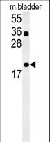 CCDC12 Antibody - CCDC12 Antibody western blot of mouse bladder tissue lysates (15 ug/lane). The CCDC12 antibody detected CCDC12 protein (arrow).