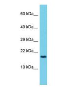 CCDC12 Antibody - Western blot of CCDC12 Antibody - C-terminal region with human 721_B cells lysate.  This image was taken for the unconjugated form of this product. Other forms have not been tested.