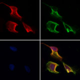 CCDC120 Antibody - Staining HeLa cells by IF/ICC. The samples were fixed with PFA and permeabilized in 0.1% Triton X-100, then blocked in 10% serum for 45 min at 25°C. Samples were then incubated with primary Ab(1:200) and mouse anti-beta tubulin Ab(1:200) for 1 hour at 37°C. An AlexaFluor594 conjugated goat anti-rabbit IgG(H+L) Ab(1:200 Red) and an AlexaFluor488 conjugated goat anti-mouse IgG(H+L) Ab(1:600 Green) were used as the secondary antibod