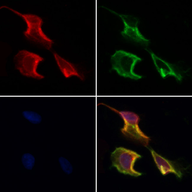 CCDC120 Antibody - Staining HeLa cells by IF/ICC. The samples were fixed with PFA and permeabilized in 0.1% Triton X-100, then blocked in 10% serum for 45 min at 25°C. Samples were then incubated with primary Ab(1:200) and mouse anti-beta tubulin Ab(1:200) for 1 hour at 37°C. An AlexaFluor594 conjugated goat anti-rabbit IgG(H+L) Ab(1:200 Red) and an AlexaFluor488 conjugated goat anti-mouse IgG(H+L) Ab(1:600 Green) were used as the secondary antibod