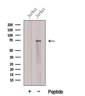 CCDC120 Antibody