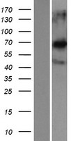 CCDC120 Protein - Western validation with an anti-DDK antibody * L: Control HEK293 lysate R: Over-expression lysate