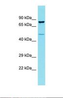 CCDC121 Antibody - Western blot of Human OVCAR-3. CCDC121 antibody dilution 1.0 ug/ml.  This image was taken for the unconjugated form of this product. Other forms have not been tested.