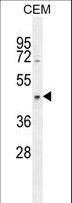 CCDC122 Antibody - CCDC122 Antibody western blot of CEM cell line lysates (35 ug/lane). The CCDC122 antibody detected the CCDC122 protein (arrow).