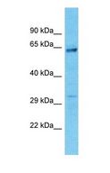 CCDC122 Antibody - Western blot of CCDC122 Antibody with human 721_B Whole Cell lysate.  This image was taken for the unconjugated form of this product. Other forms have not been tested.