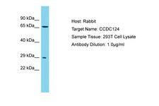 CCDC124 Antibody -  This image was taken for the unconjugated form of this product. Other forms have not been tested.
