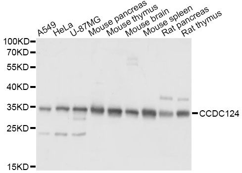 CCDC124 Antibody - Western blot analysis of extracts of various cell lines, using CCDC124 antibody at 1:1000 dilution. The secondary antibody used was an HRP Goat Anti-Rabbit IgG (H+L) at 1:10000 dilution. Lysates were loaded 25ug per lane and 3% nonfat dry milk in TBST was used for blocking. An ECL Kit was used for detection and the exposure time was 1s.