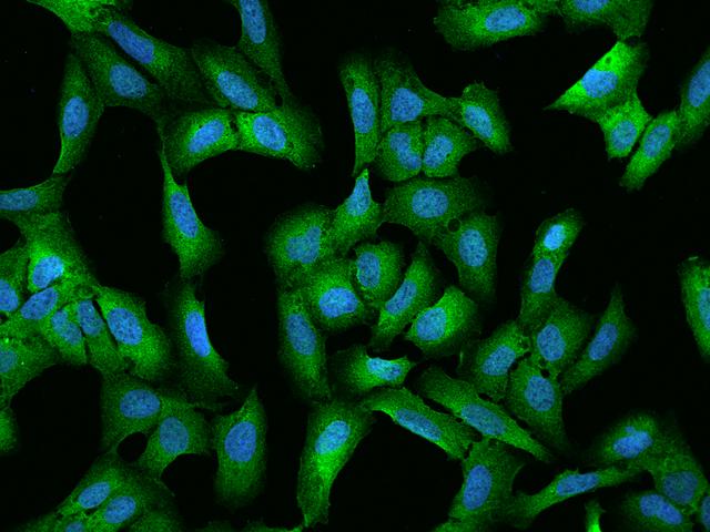 CCDC124 Antibody - Immunofluorescence staining of CCDC124 in U2OS cells. Cells were fixed with 4% PFA, permeabilzed with 0.1% Triton X-100 in PBS, blocked with 10% serum, and incubated with rabbit anti-Human CCDC124 polyclonal antibody (dilution ratio 1:100) at 4°C overnight. Then cells were stained with the Alexa Fluor 488-conjugated Goat Anti-rabbit IgG secondary antibody (green) and counterstained with DAPI (blue). Positive staining was localized to Cytoplasm.