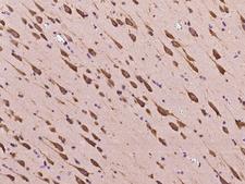 CCDC124 Antibody - Immunochemical staining of human CCDC124 in human brain with rabbit polyclonal antibody at 1:500 dilution, formalin-fixed paraffin embedded sections.