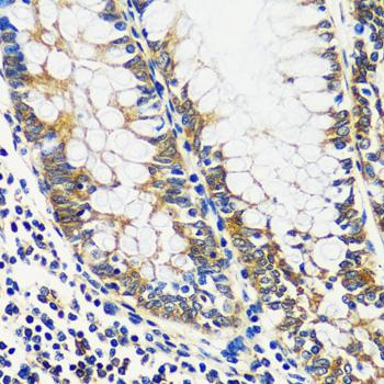 CCDC124 Antibody - Immunohistochemistry of paraffin-embedded Human colon using CCDC124 Polyclonal Antibody at dilution of 1:100 (40x lens).