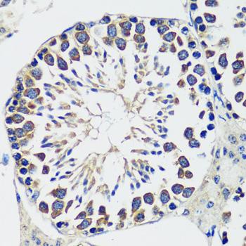 CCDC124 Antibody - Immunohistochemistry of paraffin-embedded Mouse testis using CCDC124 Polyclonal Antibody at dilution of 1:100 (40x lens).