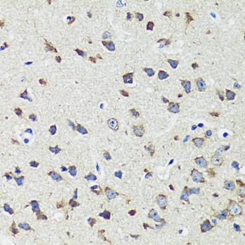 CCDC124 Antibody - Immunohistochemistry of paraffin-embedded Mouse brain using CCDC124 Polyclonal Antibody at dilution of 1:100 (40x lens).