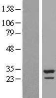 CCDC124 Protein - Western validation with an anti-DDK antibody * L: Control HEK293 lysate R: Over-expression lysate