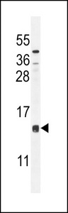 CCDC126 Antibody - CCDC126 Antibody western blot of mouse liver tissue lysates (35 ug/lane). The CCDC126 antibody detected the CCDC126 protein (arrow).