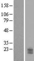CCDC126 Protein - Western validation with an anti-DDK antibody * L: Control HEK293 lysate R: Over-expression lysate