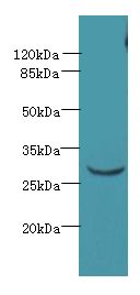 CCDC127 Antibody - Western blot. All lanes: CCDC127 antibody at 6 ug/ml+ Mouse kidney tissue Goat polyclonal to rabbit at 1:10000 dilution. Predicted band size: 31 kDa. Observed band size: 31 kDa.